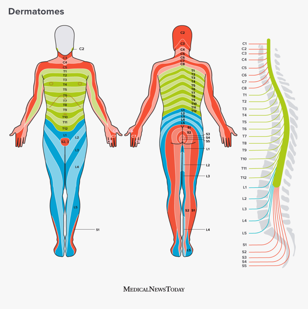 Dermatome Chart Nerve Paths That Shingles Follow