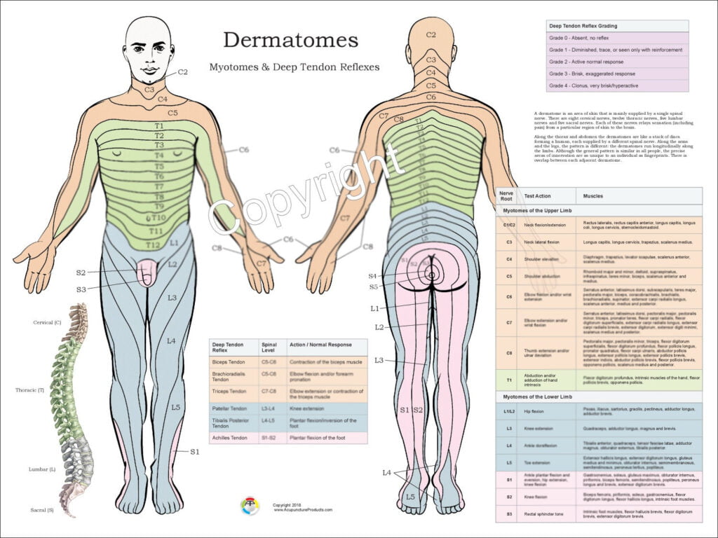 Abdominal Dermatome Mapdermatomes Myotomes And Dtr Poster 24 X 36 Chiropractic Etsy Spinal