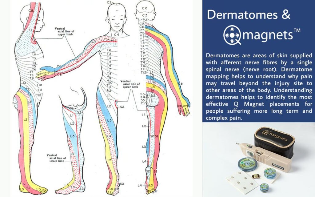 Nerve Dermatome Mapphysio Life Today Dermatome