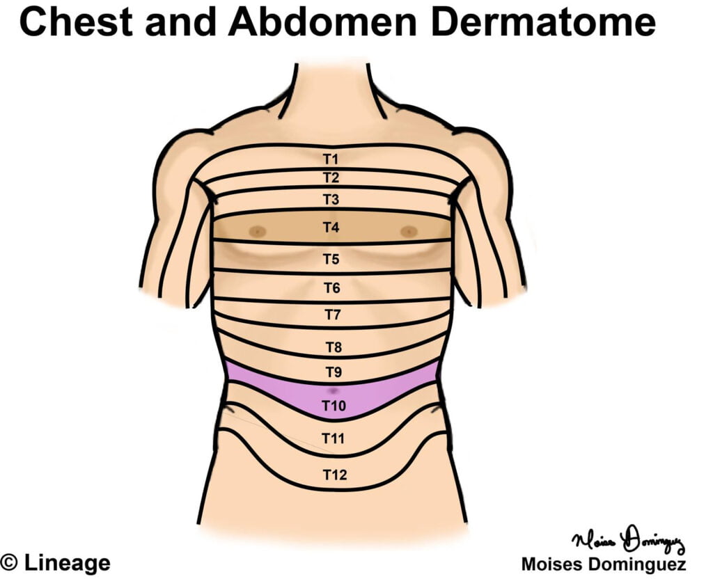 T4 Dermatome Mapdermatomes Neurology Medbullets Step 1 2