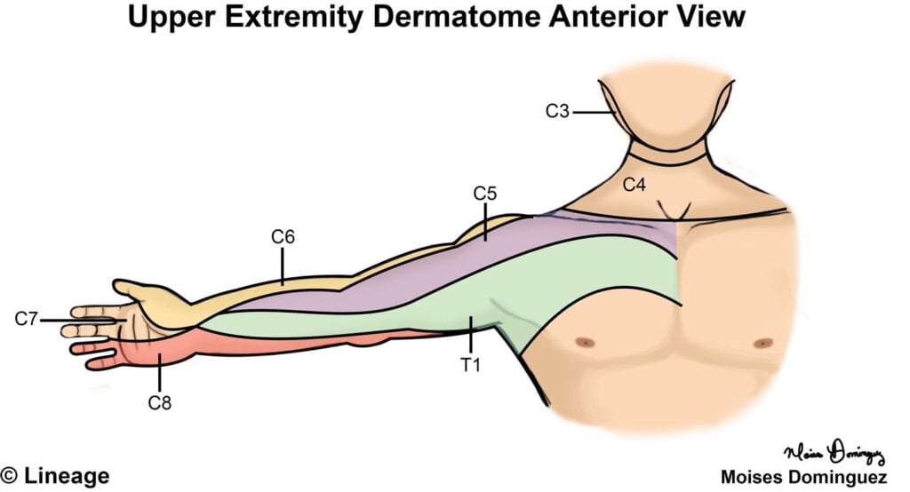 Dermatome Chart Upper Limb