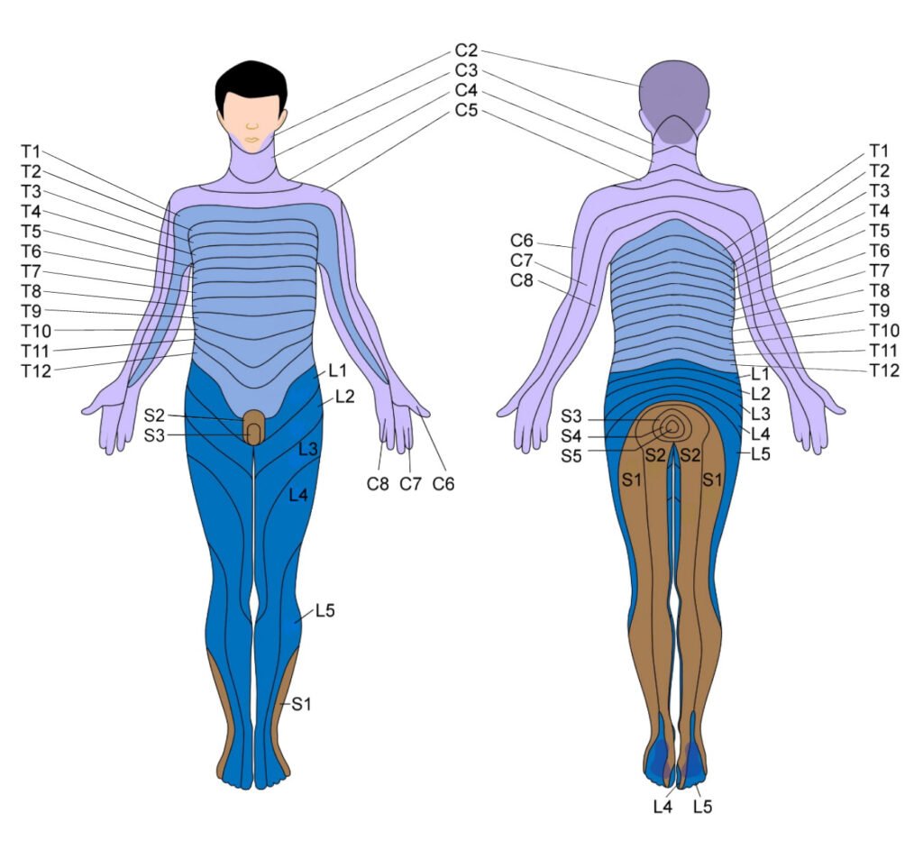 Dermatome Map Lumbarlumbar Disc Herniation